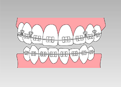 それぞれの患者さまに応じた矯正歯科をご紹介したいと思っています。