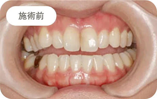 施術前1