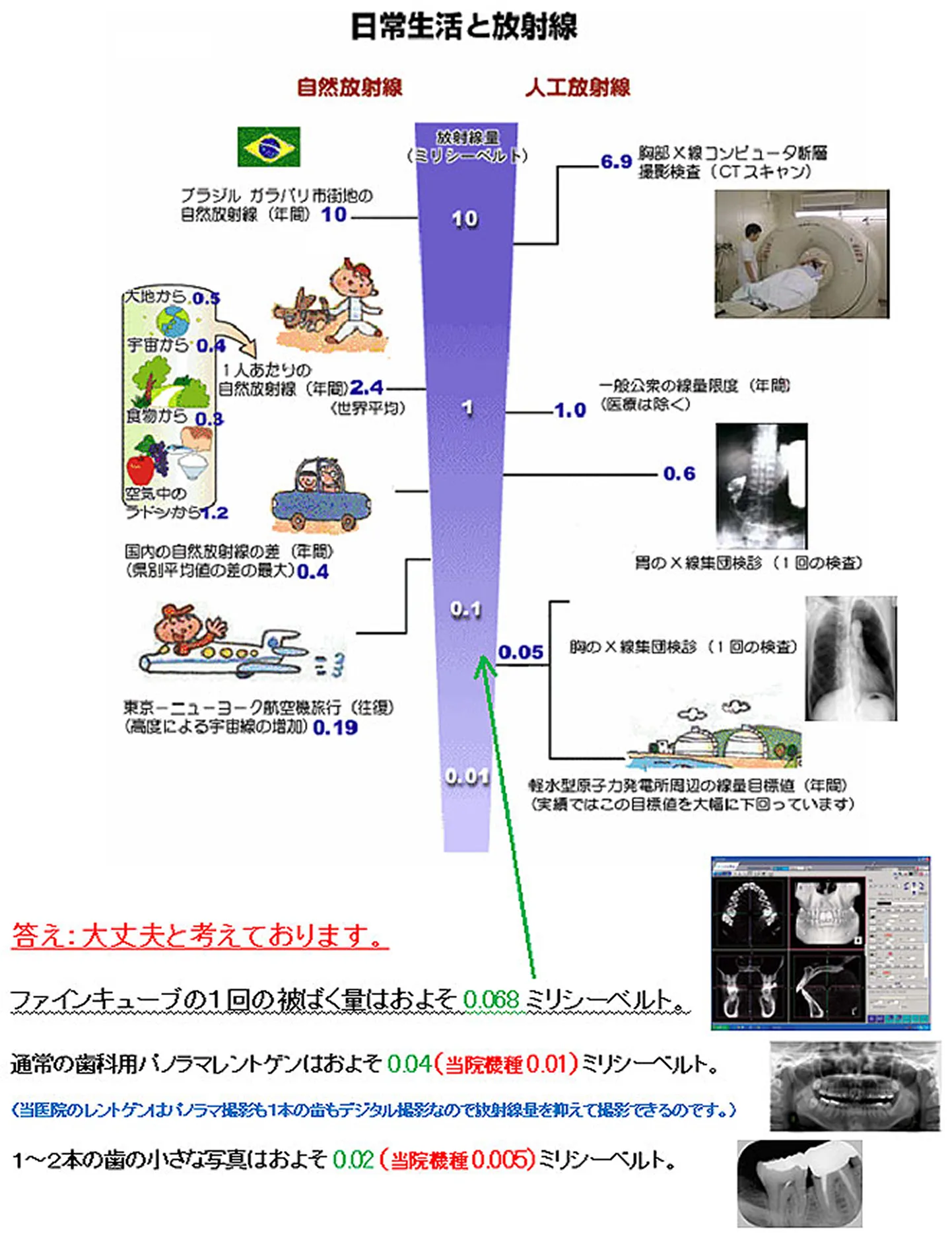 歯科用CTの放射線被ばく量について